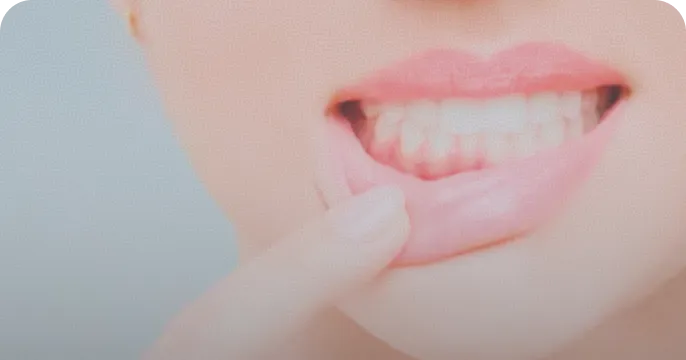 歯周病治療