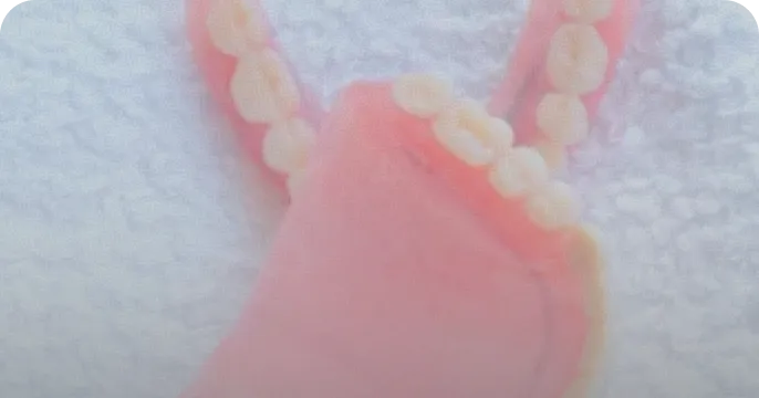 義歯治療